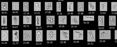 生物制药研发-蛋白质聚集体.jpg