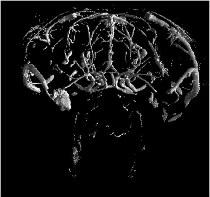 neurological-studies.jpeg