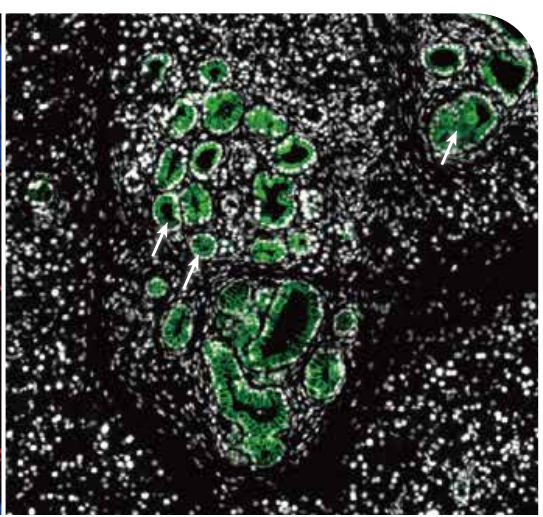 癌症生物学应用.png 癌症生物学应用.png