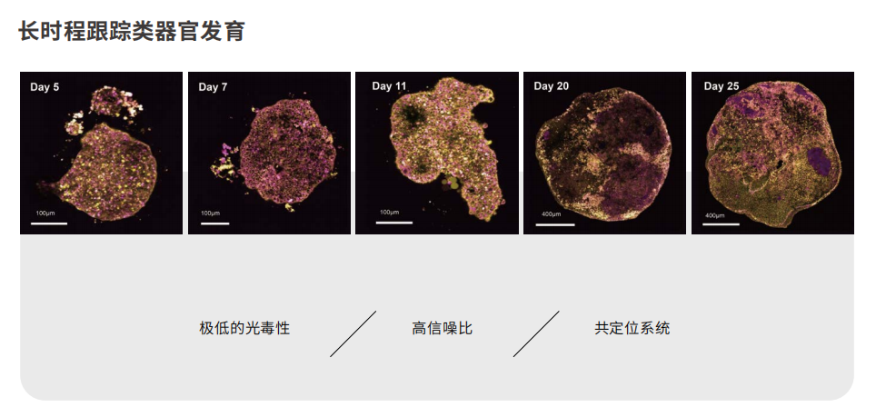 应用2-长时程跟踪类器官发育.png 应用2-长时程跟踪类器官发育.png