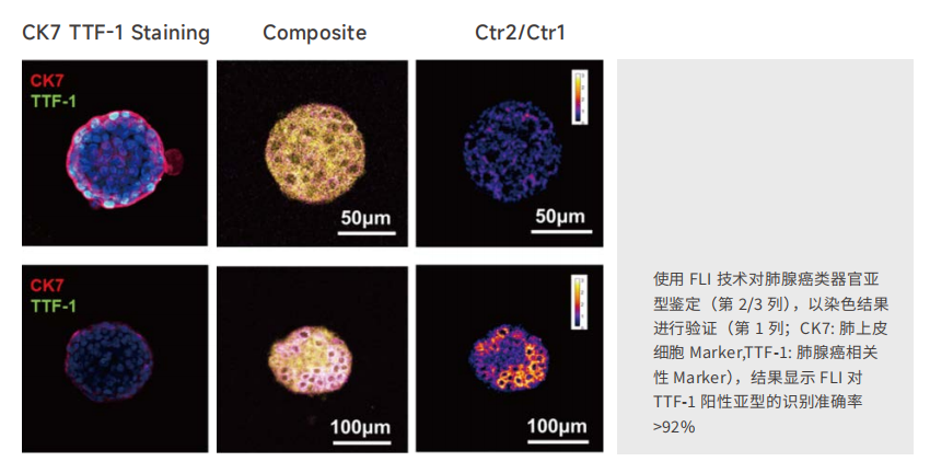 应用6-类器官亚型鉴定-2.png 应用6-类器官亚型鉴定-2.png